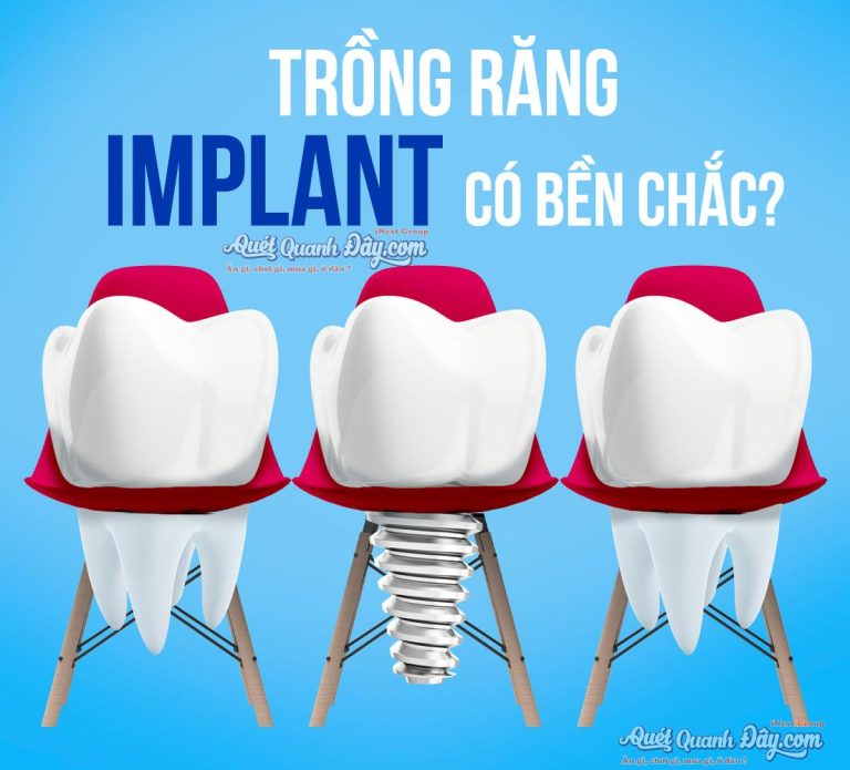 Nha Khoa Đất Mũi