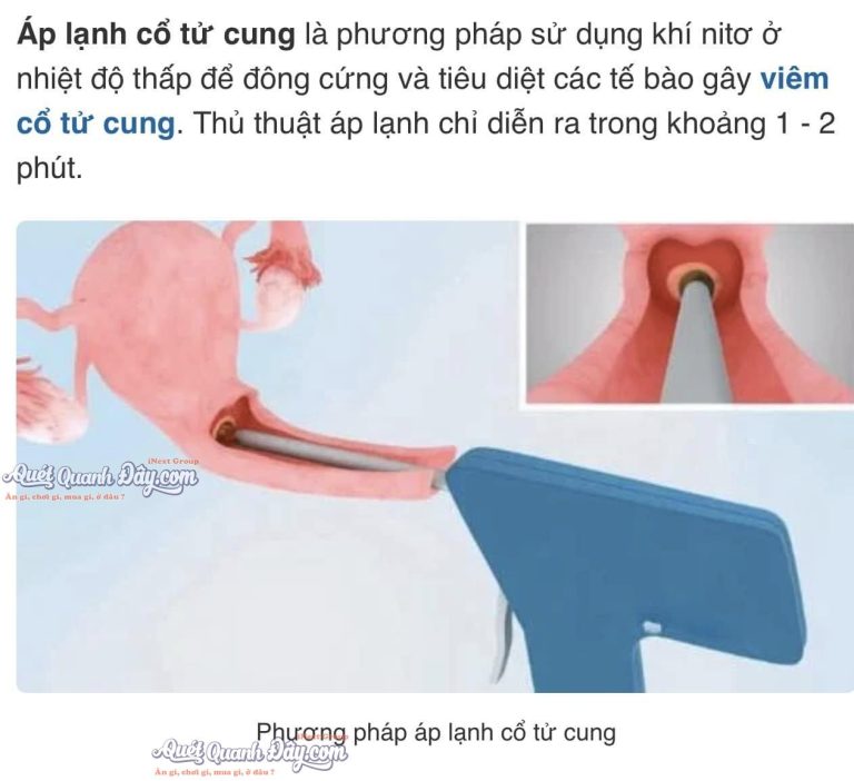 Phòng Khám Sản Phụ Khoa - BS CK1 Thanh Tuyền